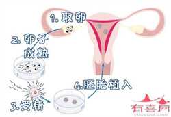 广州赠卵代生选性别价格，孕妇过安检胎儿受辐射？包内有哪种物品会开箱检查