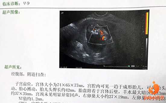 广西卵巢早衰供卵中心,【广州卵巢早衰供卵价格】顺利排卵， 明天官方，备孕