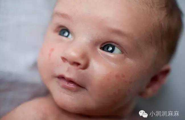 广州捐卵哪里安全，在广州哪里做试管婴儿比较好？