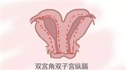佛山代孕会判刑吗,广州捐卵试管代孕医院排名，附捐卵试管费用明细！